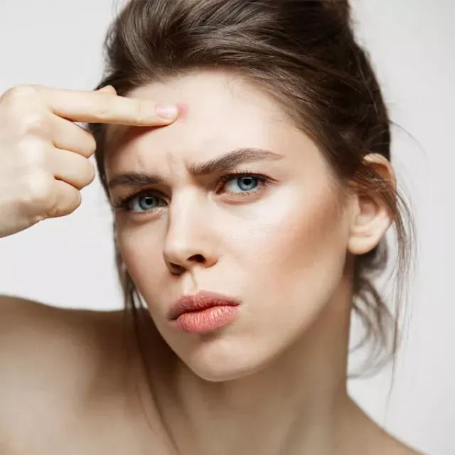 Problematická aknózní pleť